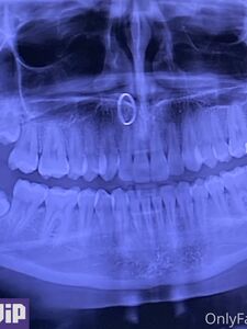 bab 420 new hot onlyfans leaked nudes