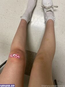 dickallergy onlyfans leaks nude photos